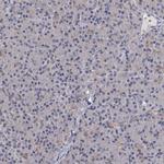 GST Omega 1 140A Antibody in Immunohistochemistry (Paraffin) (IHC (P))