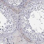 GST Omega 1 140A Antibody in Immunohistochemistry (Paraffin) (IHC (P))