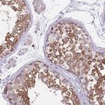 DDX4 Antibody in Immunohistochemistry (Paraffin) (IHC (P))