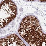 DDX4 Antibody in Immunohistochemistry (Paraffin) (IHC (P))