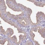 Arylsulfatase B Antibody in Immunohistochemistry (Paraffin) (IHC (P))