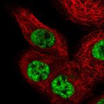 PRP19 Antibody in Immunocytochemistry (ICC/IF)