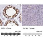 CAS Antibody