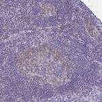 CAS Antibody in Immunohistochemistry (Paraffin) (IHC (P))