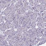 CAS Antibody in Immunohistochemistry (Paraffin) (IHC (P))