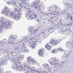 CAS Antibody in Immunohistochemistry (Paraffin) (IHC (P))