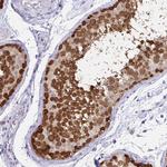 CAS Antibody in Immunohistochemistry (Paraffin) (IHC (P))