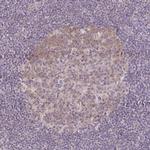 CAS Antibody in Immunohistochemistry (Paraffin) (IHC (P))