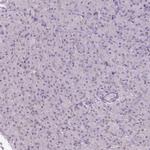 CAS Antibody in Immunohistochemistry (Paraffin) (IHC (P))