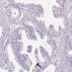 CAS Antibody in Immunohistochemistry (Paraffin) (IHC (P))