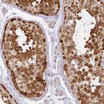 CAS Antibody in Immunohistochemistry (Paraffin) (IHC (P))