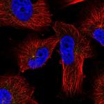 PRKAR2A Antibody in Immunocytochemistry (ICC/IF)