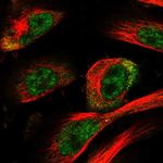 HOXC11 Antibody in Immunocytochemistry (ICC/IF)