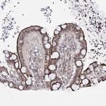 HOXC11 Antibody in Immunohistochemistry (Paraffin) (IHC (P))