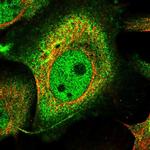 BCR Antibody in Immunocytochemistry (ICC/IF)