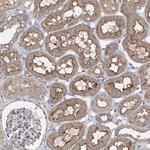 BCR Antibody in Immunohistochemistry (Paraffin) (IHC (P))