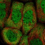 PCBP2 Antibody in Immunocytochemistry (ICC/IF)