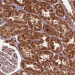 PCBP2 Antibody in Immunohistochemistry (Paraffin) (IHC (P))