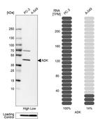 Adenosine Kinase Antibody