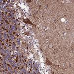 Citrate Synthase Antibody in Immunohistochemistry (Paraffin) (IHC (P))