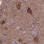 Citrate Synthase Antibody in Immunohistochemistry (Paraffin) (IHC (P))