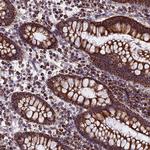 Citrate Synthase Antibody in Immunohistochemistry (Paraffin) (IHC (P))