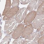 Citrate Synthase Antibody in Immunohistochemistry (Paraffin) (IHC (P))