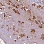 PRG2 Antibody in Immunohistochemistry (Paraffin) (IHC (P))