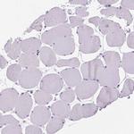 PRG2 Antibody in Immunohistochemistry (Paraffin) (IHC (P))