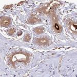 MADD Antibody in Immunohistochemistry (Paraffin) (IHC (P))