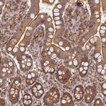 MADD Antibody in Immunohistochemistry (Paraffin) (IHC (P))