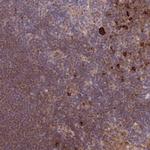 Cdc25B Antibody in Immunohistochemistry (Paraffin) (IHC (P))