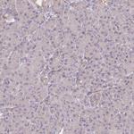 Cdc25B Antibody in Immunohistochemistry (Paraffin) (IHC (P))