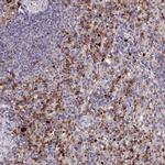 KLRB1 Antibody in Immunohistochemistry (Paraffin) (IHC (P))