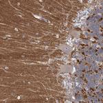 NALP10 Antibody in Immunohistochemistry (Paraffin) (IHC (P))