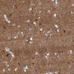 NALP10 Antibody in Immunohistochemistry (Paraffin) (IHC (P))