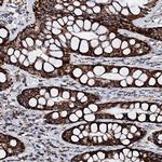 HADH Antibody in Immunohistochemistry (Paraffin) (IHC (P))