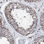 HADH Antibody in Immunohistochemistry (Paraffin) (IHC (P))