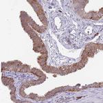 EXOSC8 Antibody in Immunohistochemistry (Paraffin) (IHC (P))