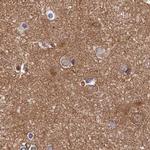 Dynactin 2 Antibody in Immunohistochemistry (Paraffin) (IHC (P))