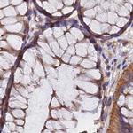 Dynactin 2 Antibody in Immunohistochemistry (Paraffin) (IHC (P))