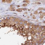 Dynactin 2 Antibody in Immunohistochemistry (Paraffin) (IHC (P))