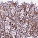 CtIP Antibody in Immunohistochemistry (Paraffin) (IHC (P))