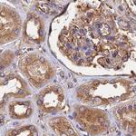 Dynactin 2 Antibody in Immunohistochemistry (Paraffin) (IHC (P))