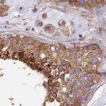 Dynactin 2 Antibody in Immunohistochemistry (Paraffin) (IHC (P))