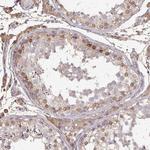 Glypican 5 Antibody in Immunohistochemistry (Paraffin) (IHC (P))