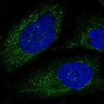 Calpain 6 Antibody in Immunocytochemistry (ICC/IF)