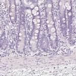 MUC5AC Antibody in Immunohistochemistry (Paraffin) (IHC (P))