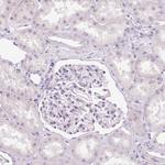 MUC5AC Antibody in Immunohistochemistry (Paraffin) (IHC (P))