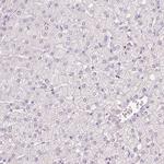 MUC5AC Antibody in Immunohistochemistry (Paraffin) (IHC (P))